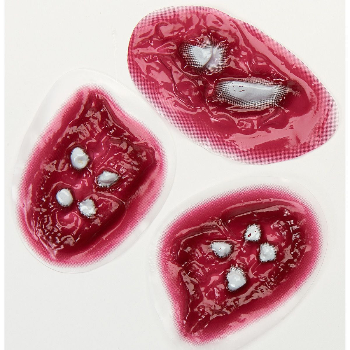 More Examples of Wounds