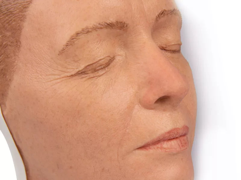 Model Head for Facial Injections 8100 Image 3