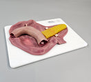 Switch Pancreatojejunostomy Anastomosis Plate A-PAP-01 Image 3 3 image
