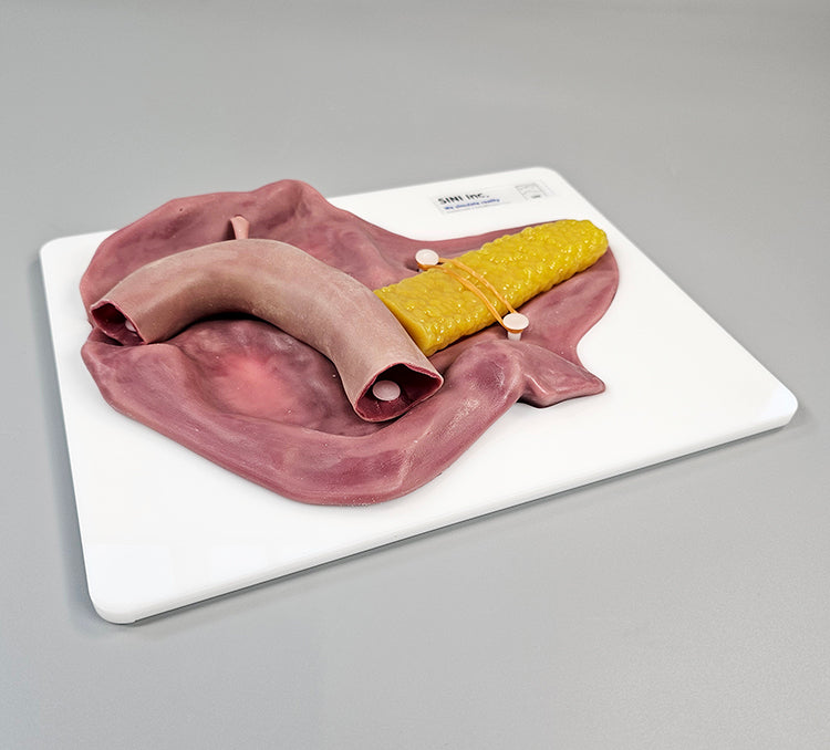 Pancreatojejunostomy Anastomosis Plate