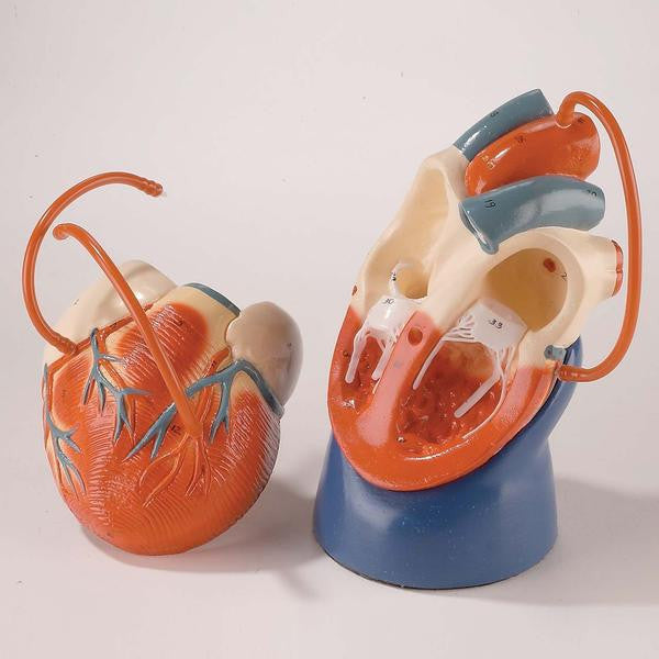 Life-Size Heart with Bypass Model