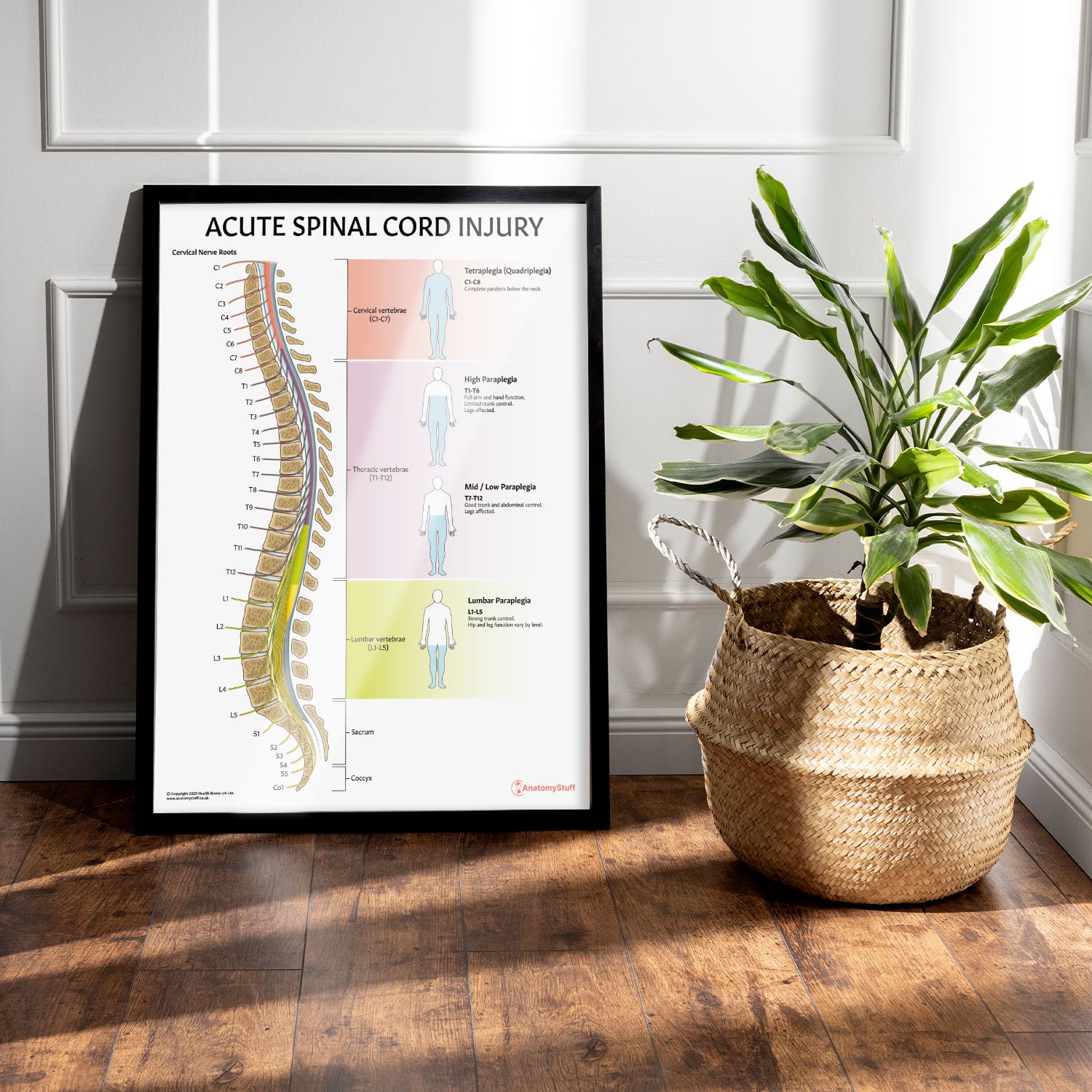Acute Spinal Cord Injury Chart / Poster
