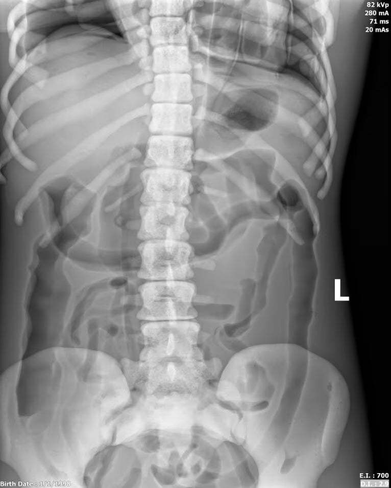 Adult Female Torso Phantom for X-Ray CT, MRI
