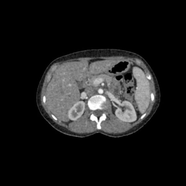 Anatomy Phantom Models for CT,  X-Ray, and Radiation Therapy