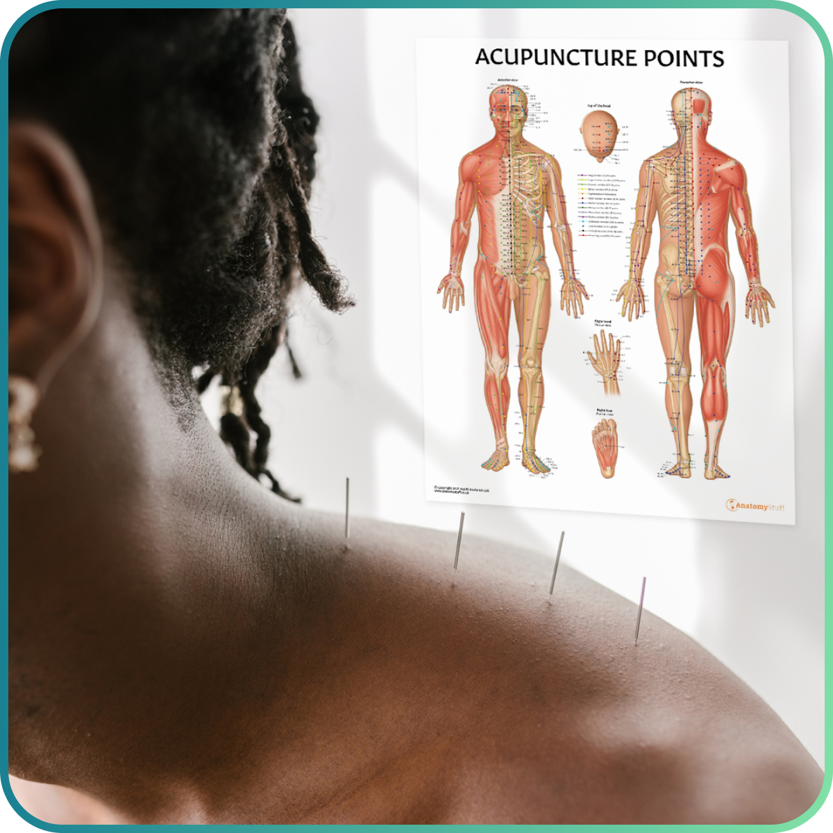 Acupuncture and Reflexology