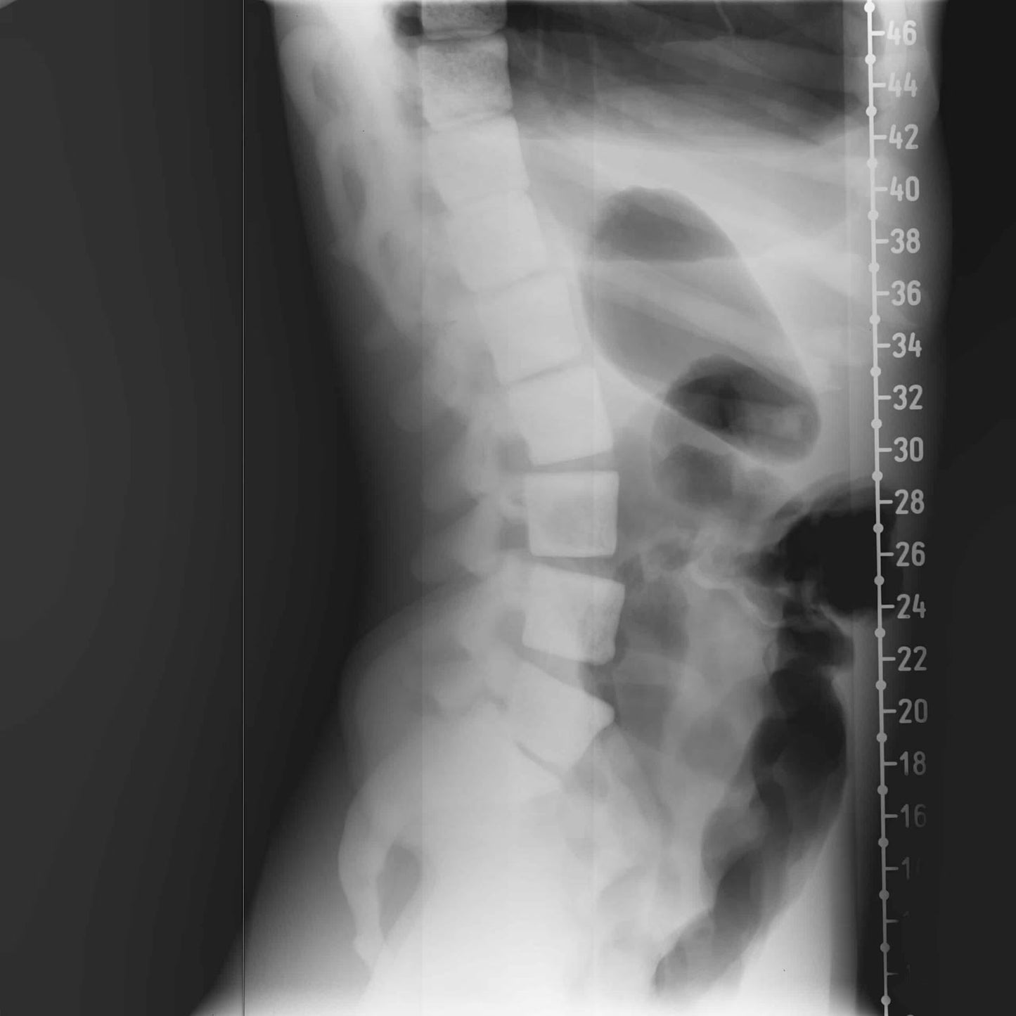 Adult Torso for X-Ray CT, MRI CT-A01 image 15
