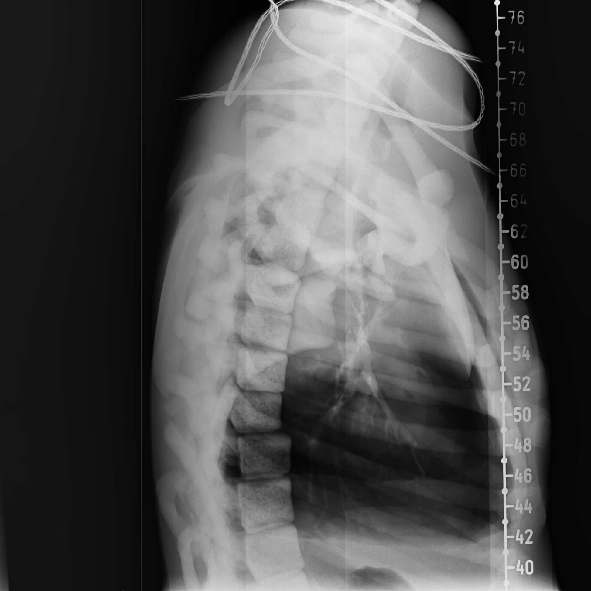 Adult Torso Phantom for X-Ray CT, MRI