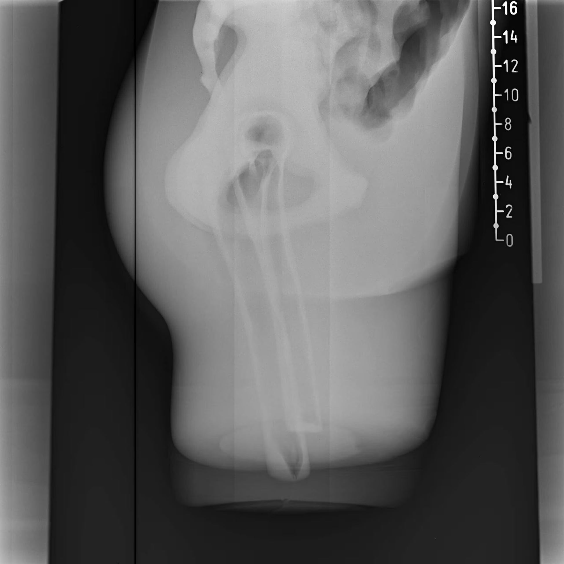 Adult Torso Phantom for X-Ray CT, MRI