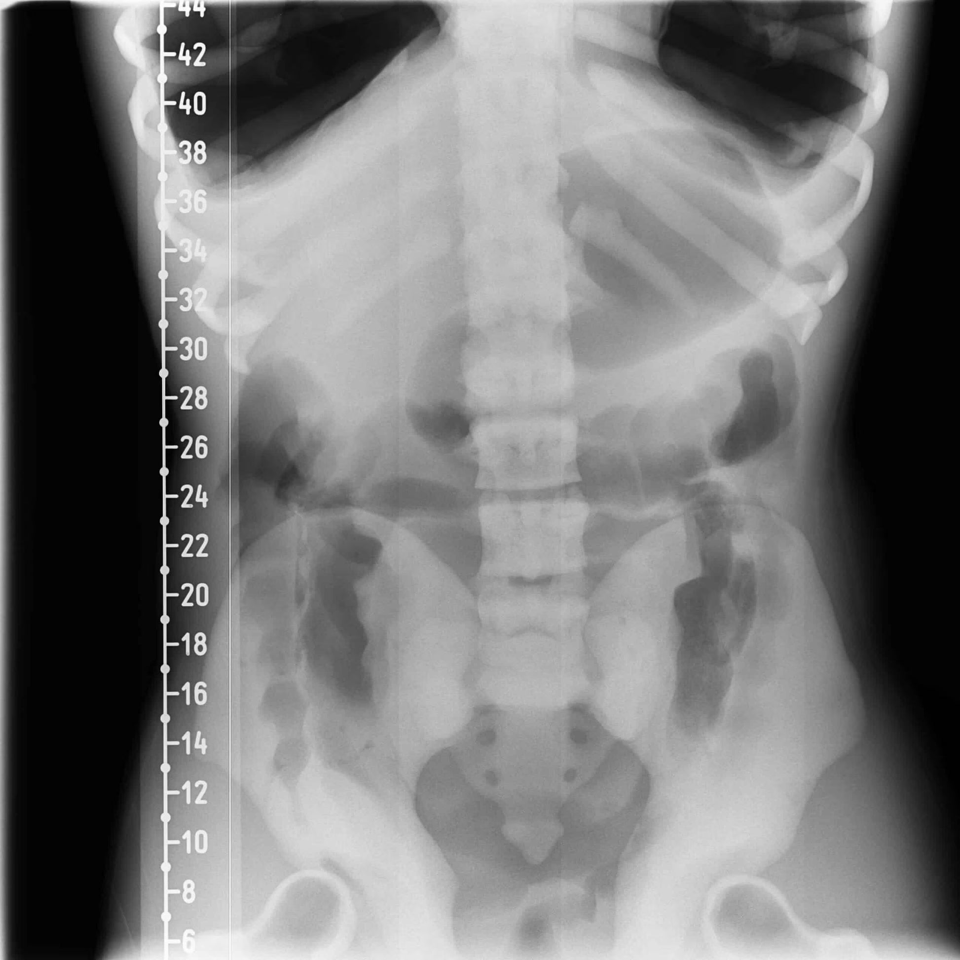 Adult Torso Phantom for X-Ray CT, MRI