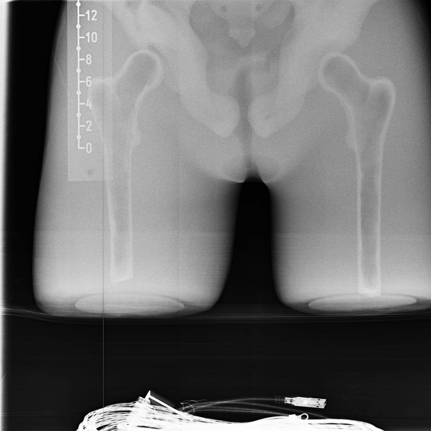 Adult Torso for X-Ray CT, MRI CT-A01 image 14