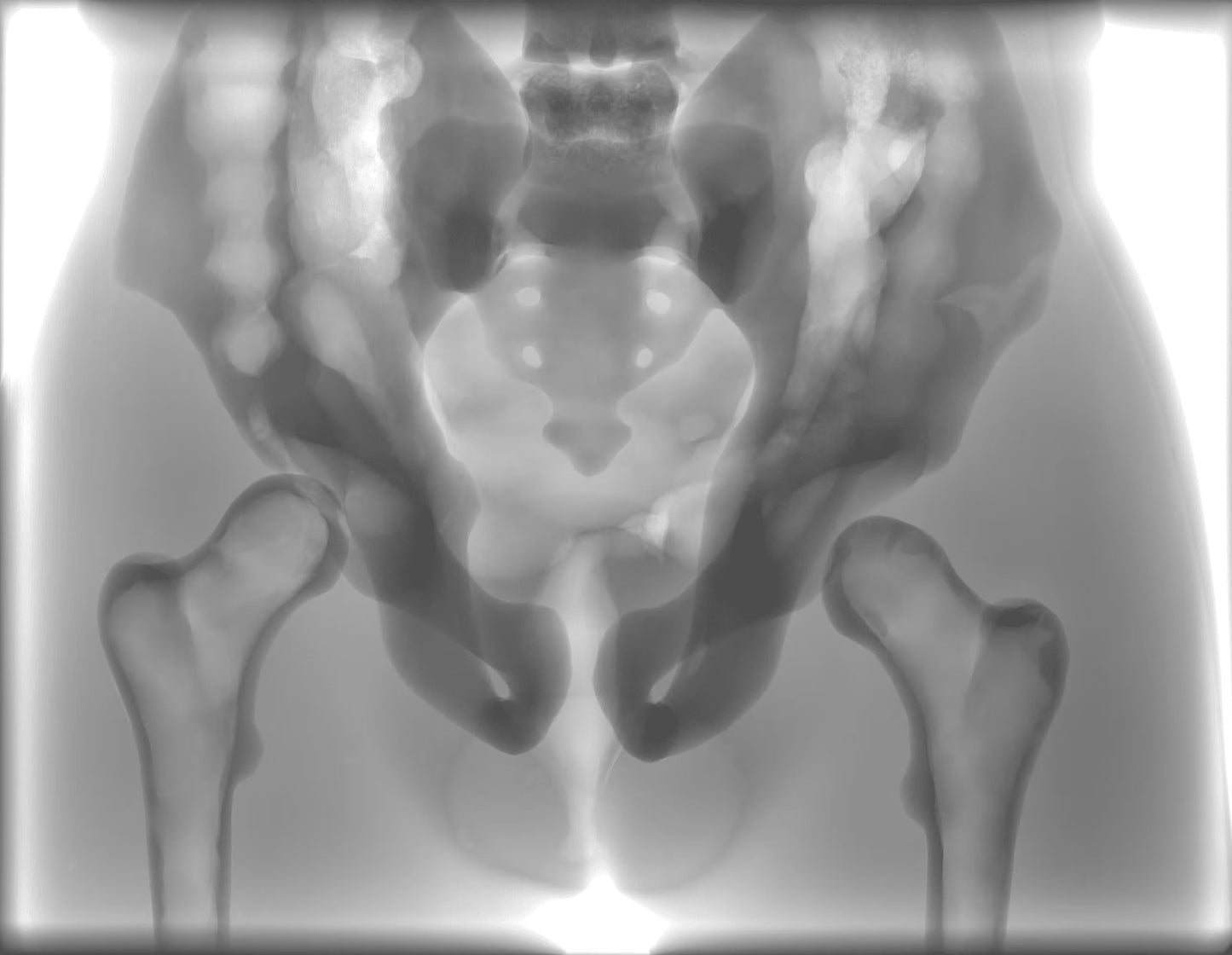 Adult Torso for X-Ray CT, MRI CT-A01 image 17