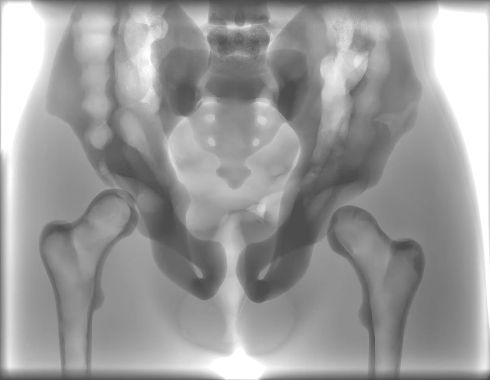 Adult Torso Phantom for X-Ray CT, MRI