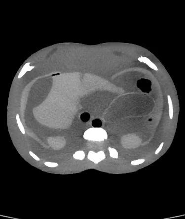 Adult Torso Phantom (Dynamic) for X-Ray CT, MRI