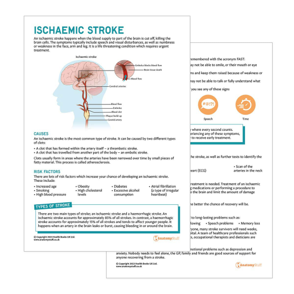 Ischaemic Stroke Patient Education Handout