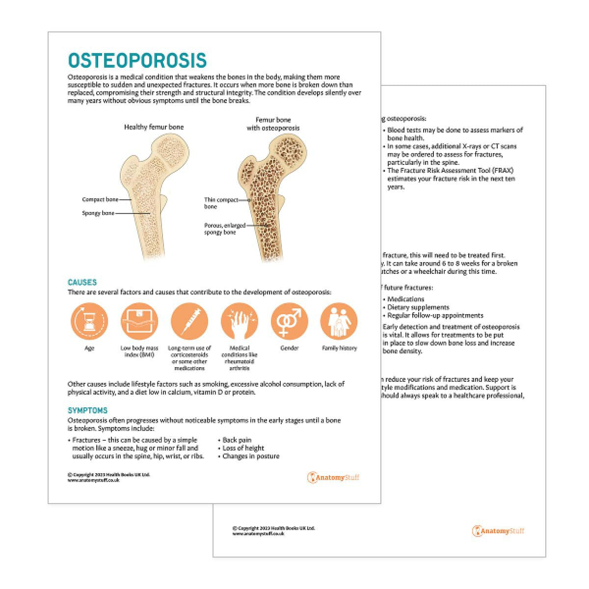 Osteoporosis Patient Education Handout