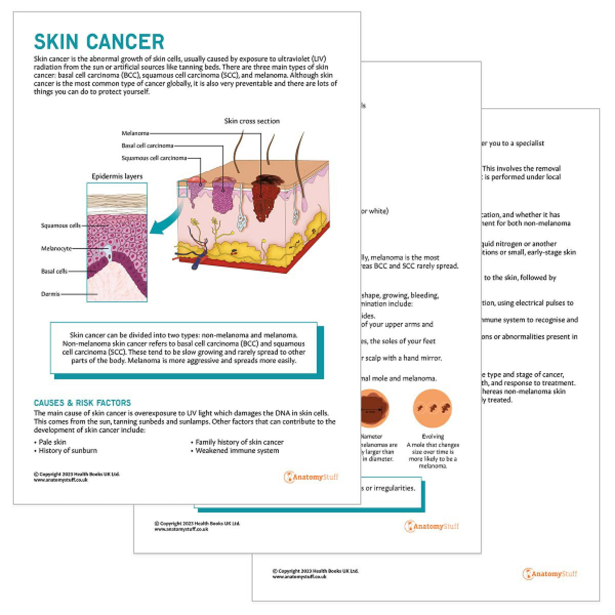 Skin Cancer Patient Education Handout (Printable PDF)