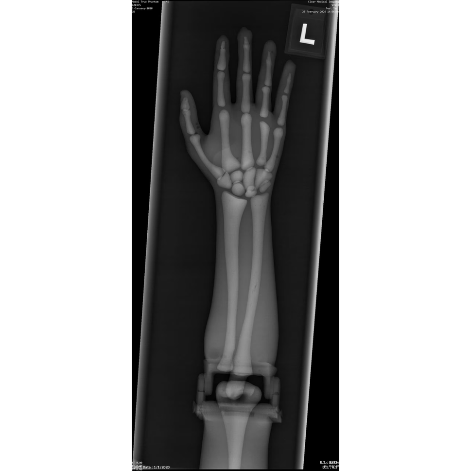Paediatric Full Body Phantom for X-Ray CT, MRI