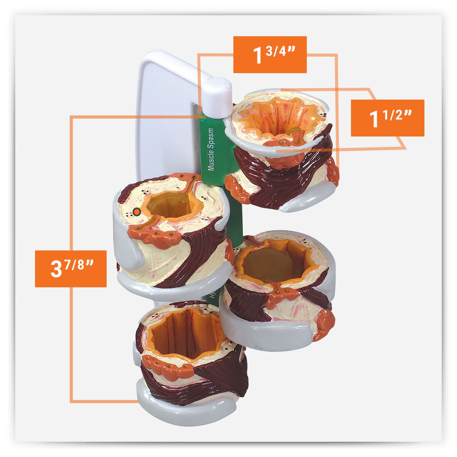 Bronchus Model (4 stages)