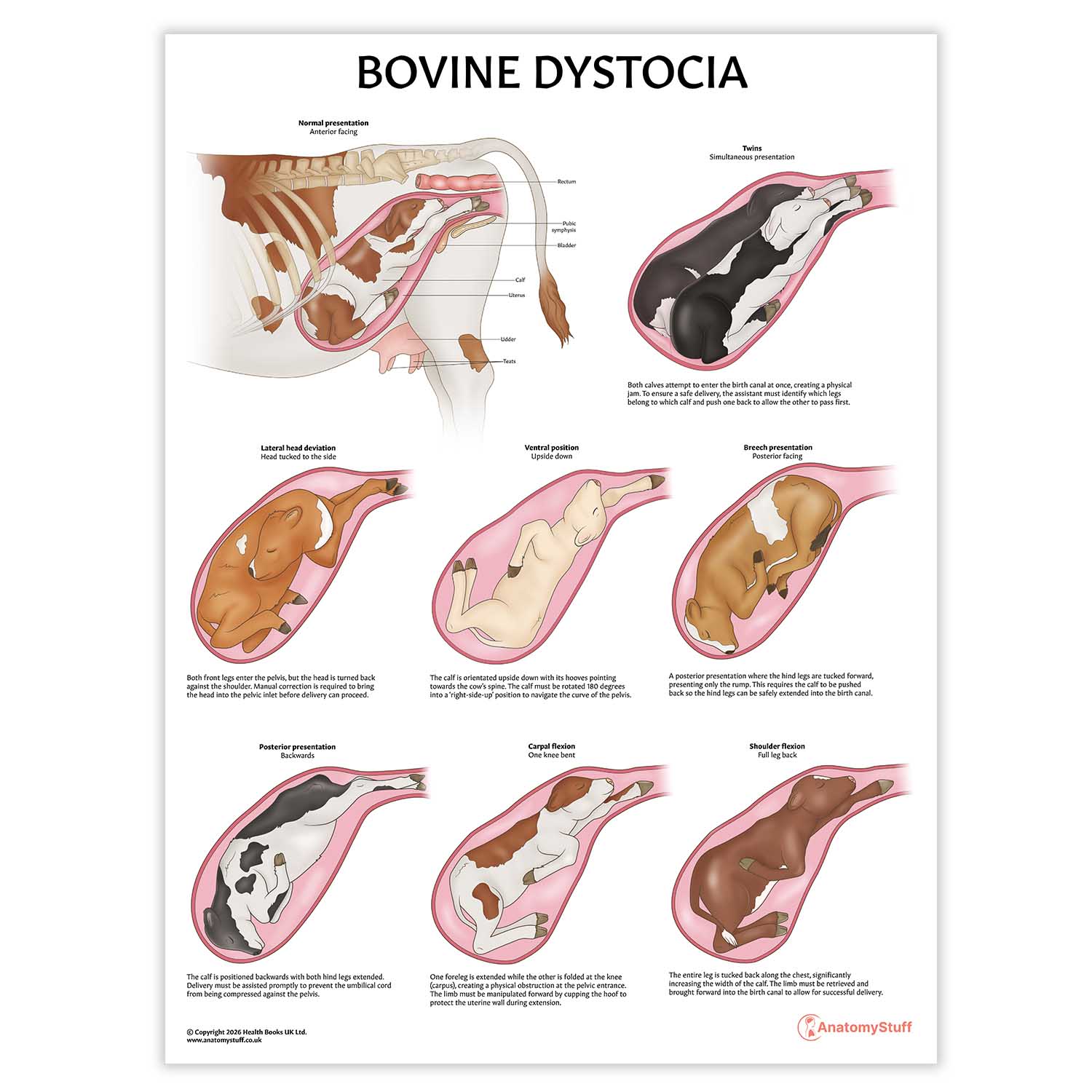 Bovine Dystocia Chart / Poster