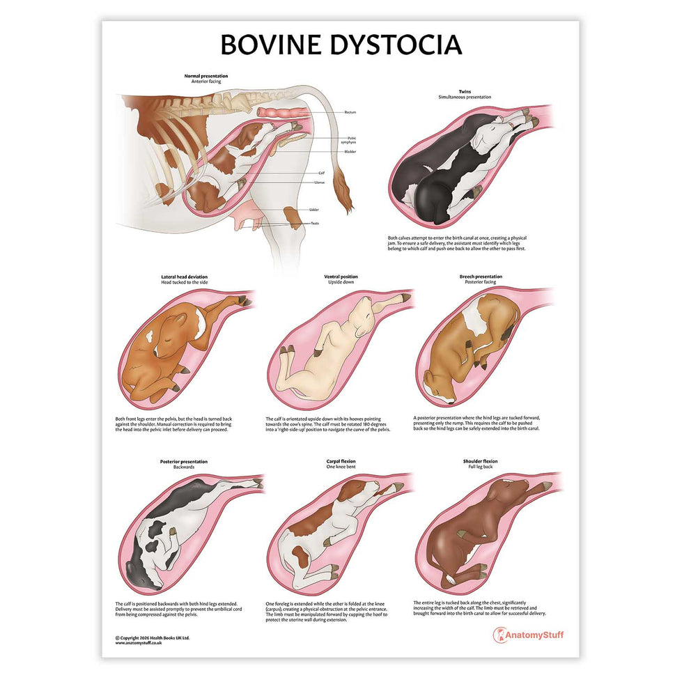 Bovine Dystocia Chart / Poster