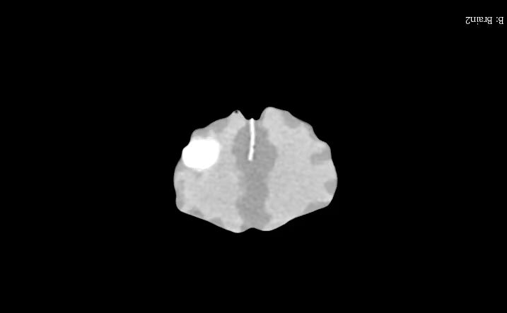 Adult Brain Phantom (Complex) for X-Ray CT, US, MRI