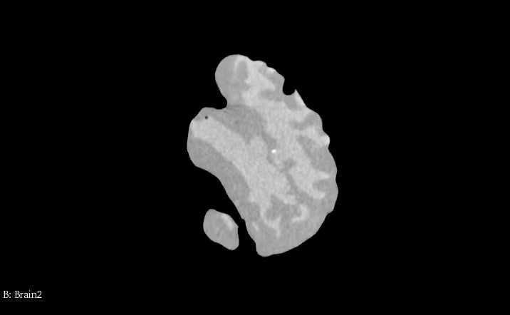 Adult Brain (Complex) for X-Ray CT, US, MRI BN-A02 image 5