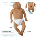 Switch Birth Defects Baby 2 image