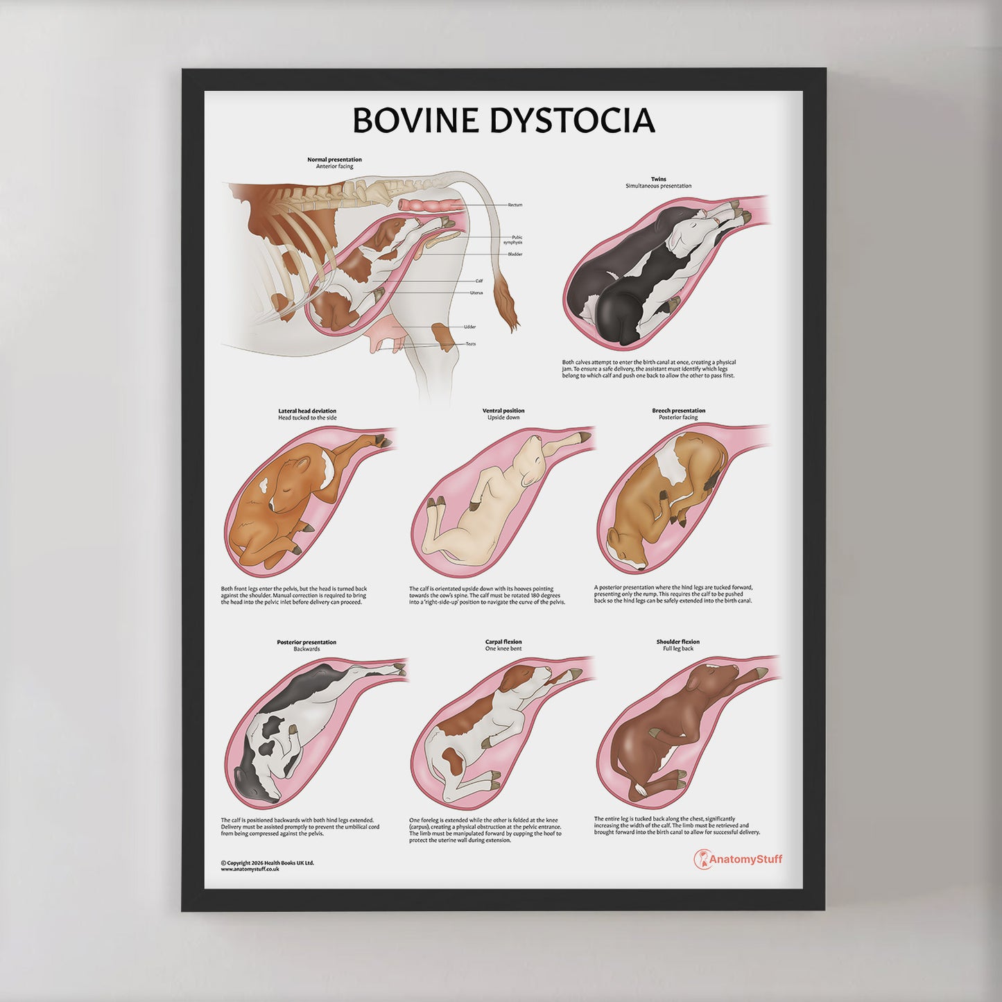 Bovine Dystocia Chart / Poster