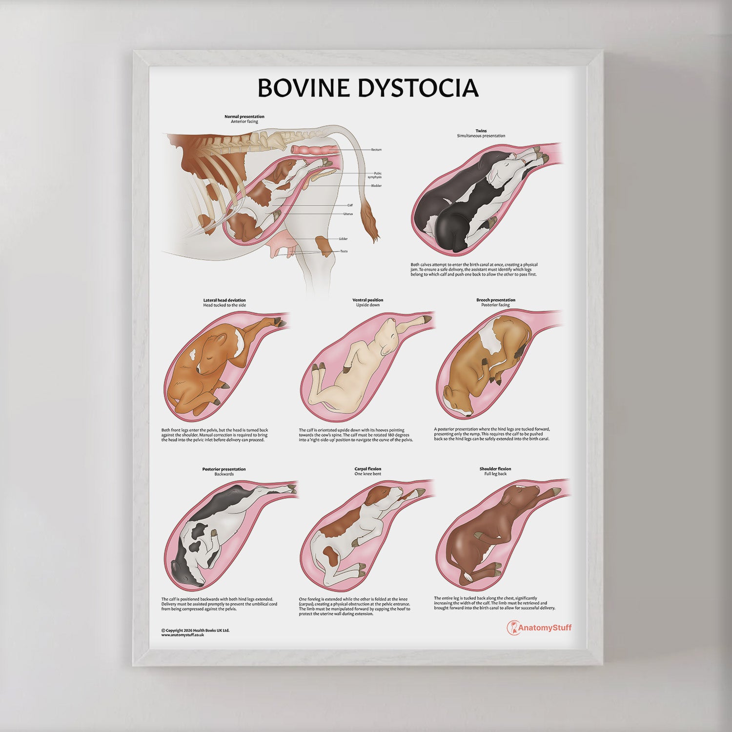 Bovine Dystocia Chart / Poster