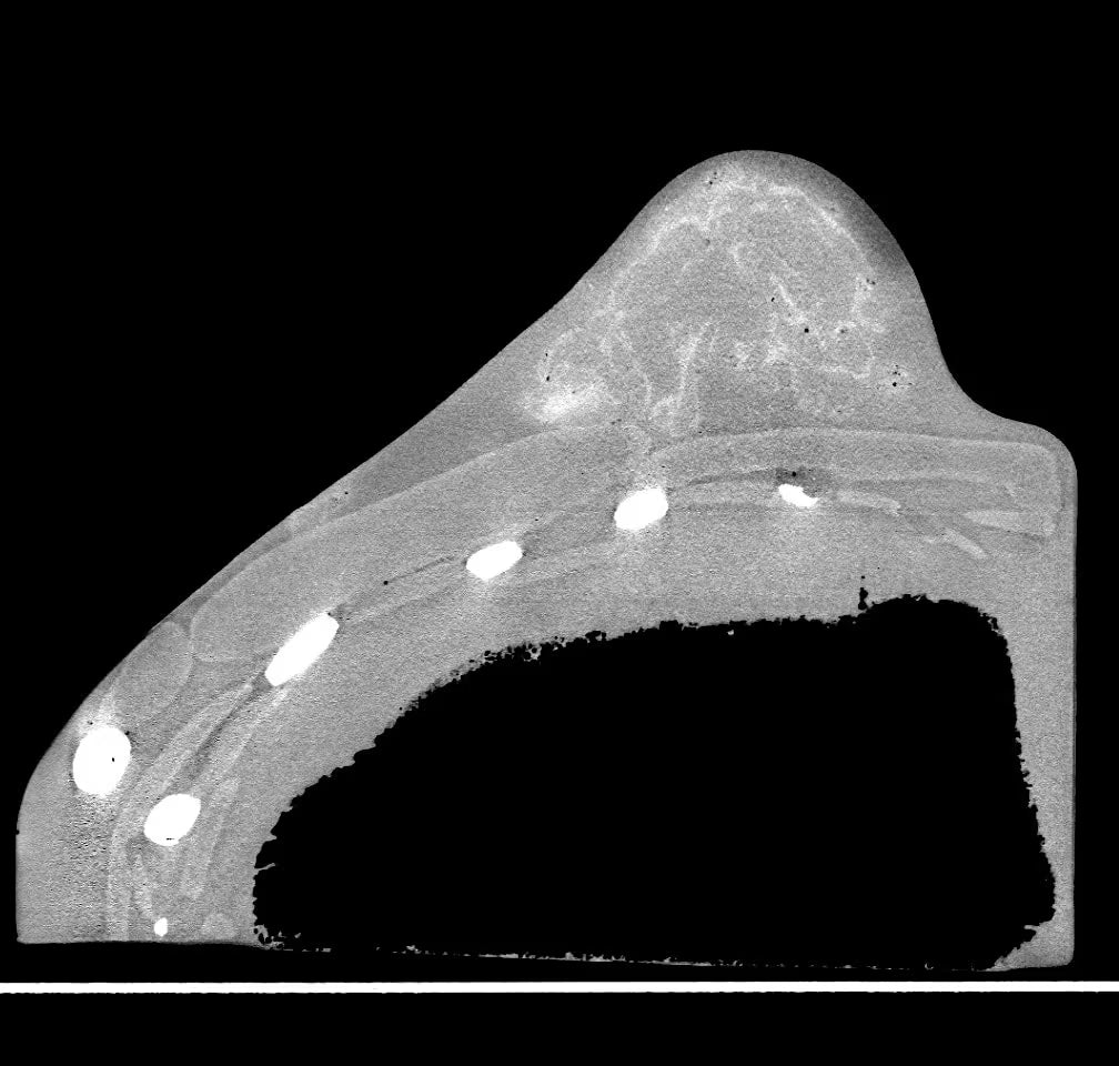 Adult Breast Phantom (Complex) for X-Ray CT, US, MRI