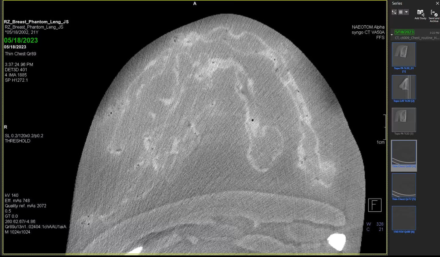Adult Breast (Complex) for X-Ray CT, US, MRI BT-A01 Image 7