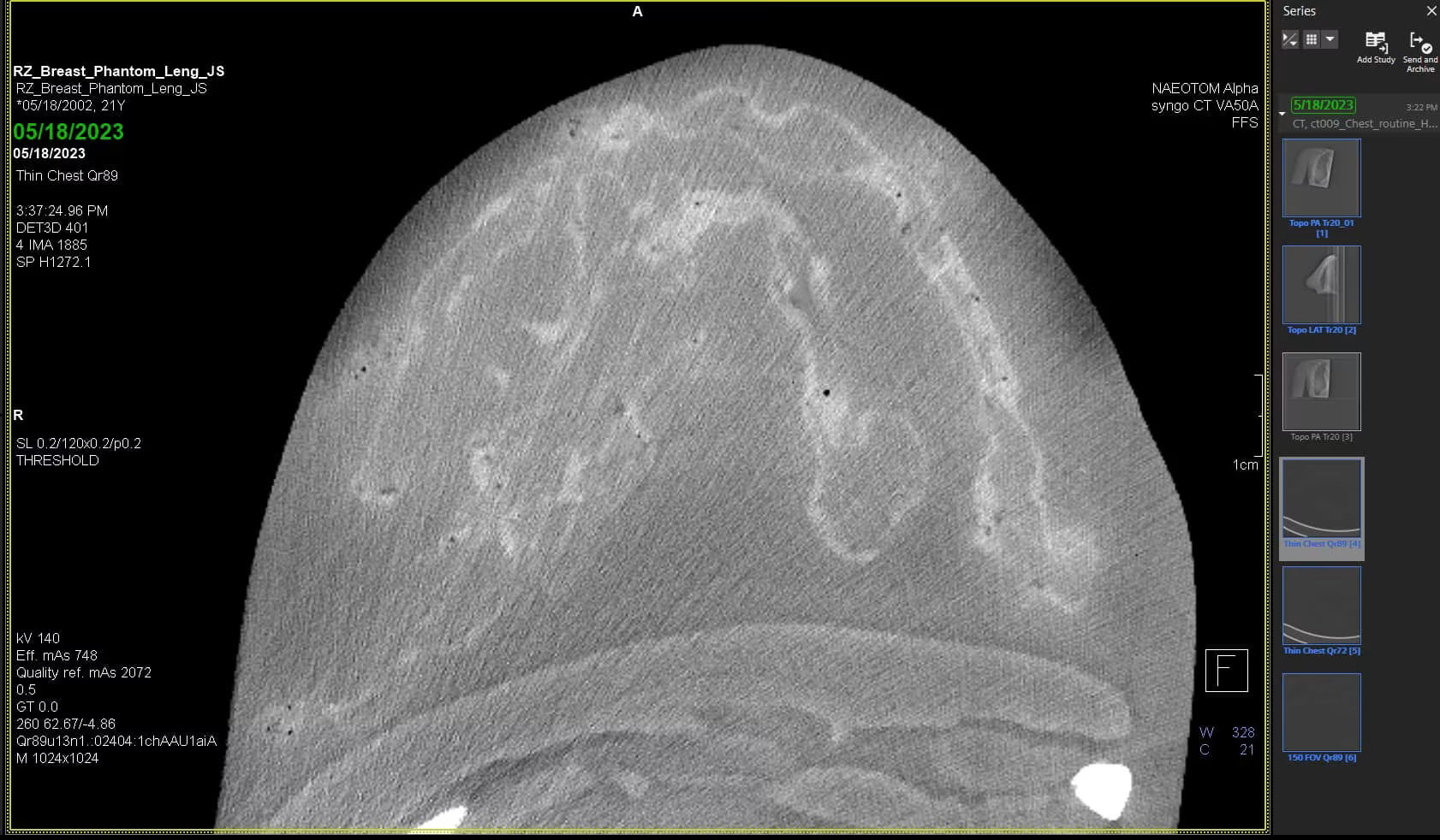 Adult Breast Phantom (Complex) for X-Ray CT, US, MRI