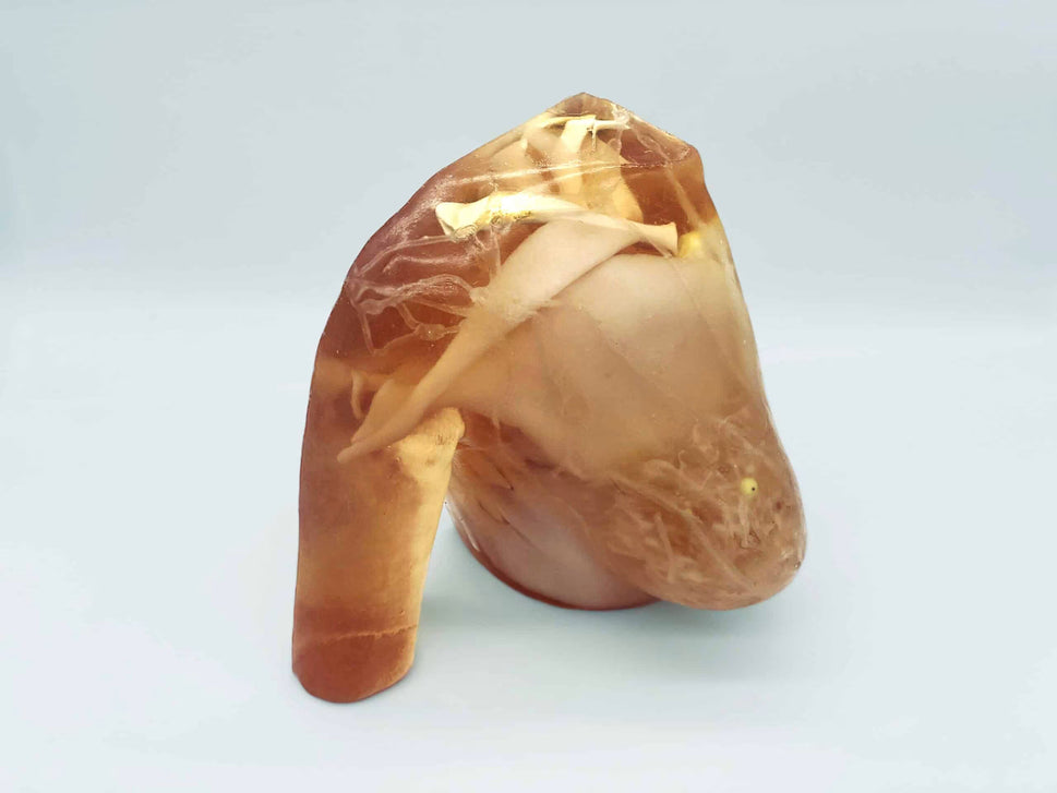 Adult Breast Phantom (Complex) for X-Ray CT, US, MRI