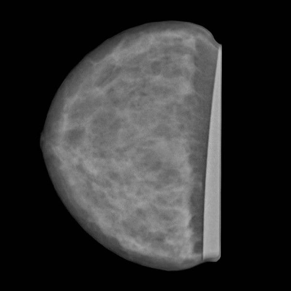 Anatomy Phantom Models for CT,  X-Ray, and Radiation Therapy