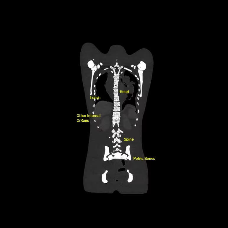 Adult Female Torso for X-Ray CT, MRI CT-A02 image 11