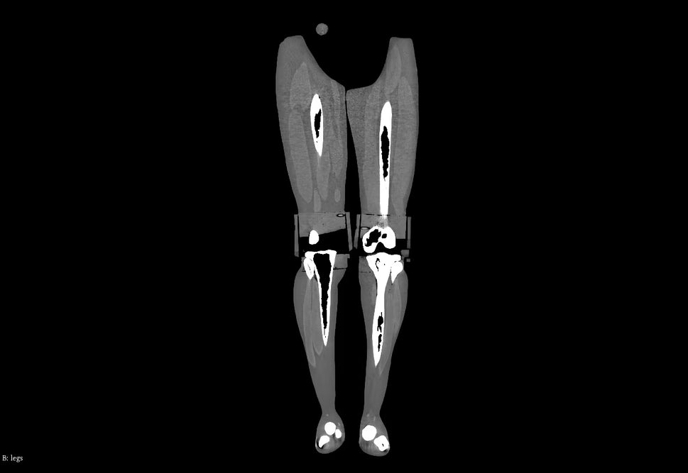 Adult Full Body Phantom with Muscles for X-Ray CT, MRI