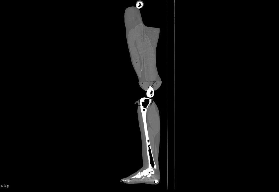 Adult Full Body Phantom with Muscles for X-Ray CT, MRI
