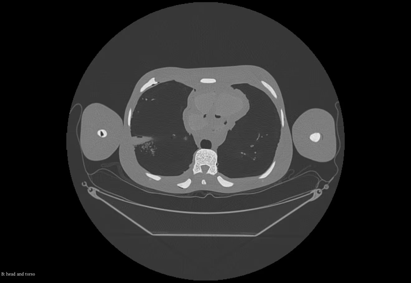 Adult Full Body with Muscles for X-Ray CT, MRI FB-A02 image 17
