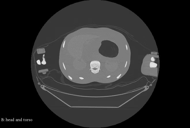 Adult Full Body Phantom with Muscles for X-Ray CT, MRI