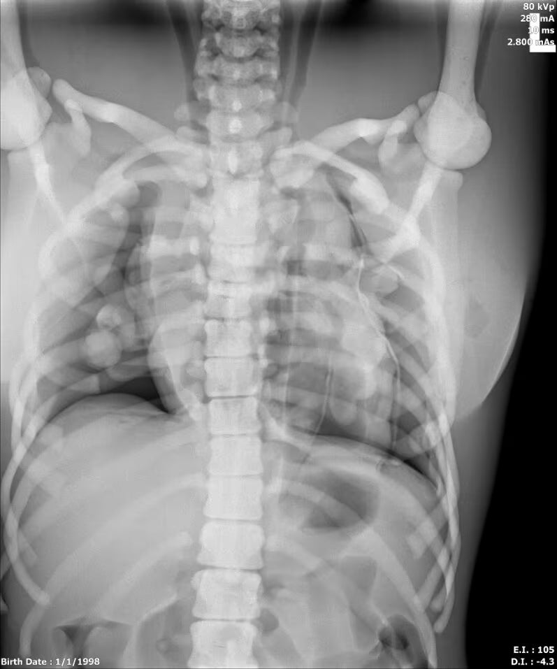 Adult Female Torso Phantom for X-Ray CT, MRI