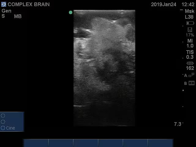 Adult Brain (Complex) for X-Ray CT, US, MRI BN-A02 image 8