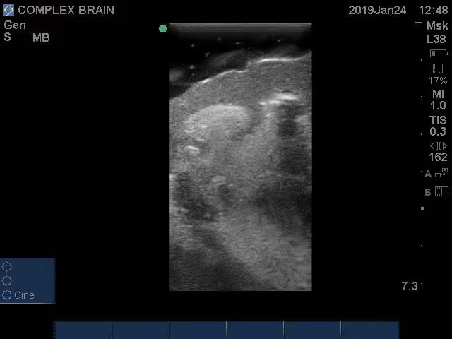 Adult Brain Phantom (Complex) for X-Ray CT, US, MRI