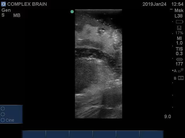 Adult Brain Phantom (Complex) for X-Ray CT, US, MRI