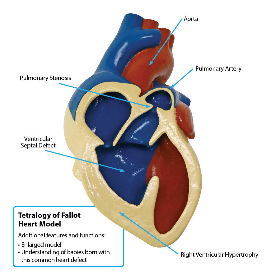 Congenital Heart Model