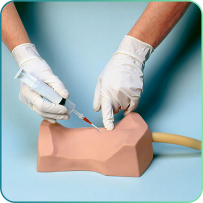 Cricothyrotomy