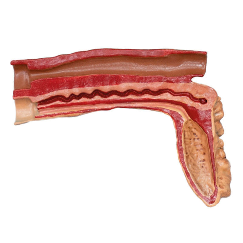 Cross Section View Of Pig Uterus