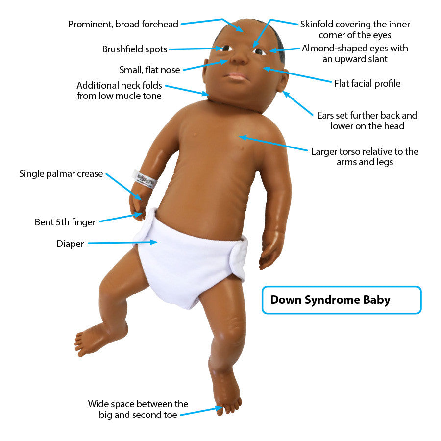 Birth Defects and Disorder Model Set