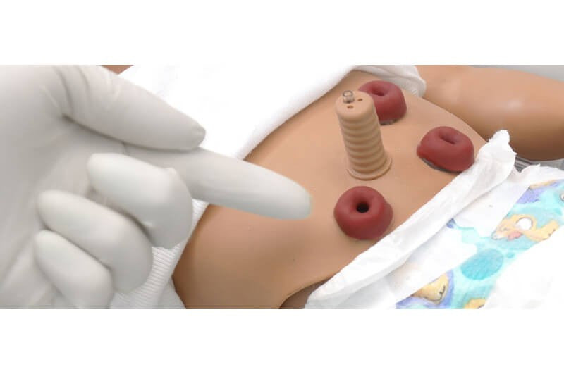 External Stoma Sites Option For SUSIE and SIMON Newborn Advanced Care Simulator