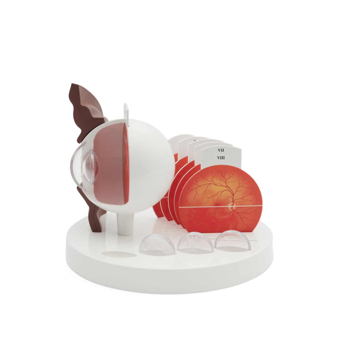 Pathological Eye Model