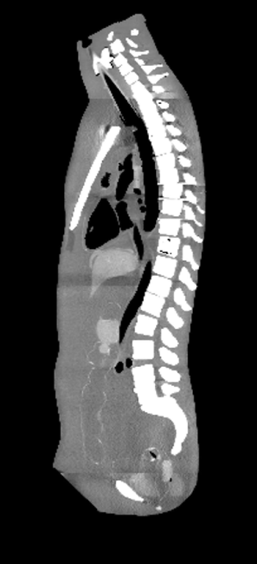 Medical Imaging Phantoms for X-Ray, CT, MRI and Ultrasound
